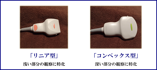 リニア型とコンベックス型